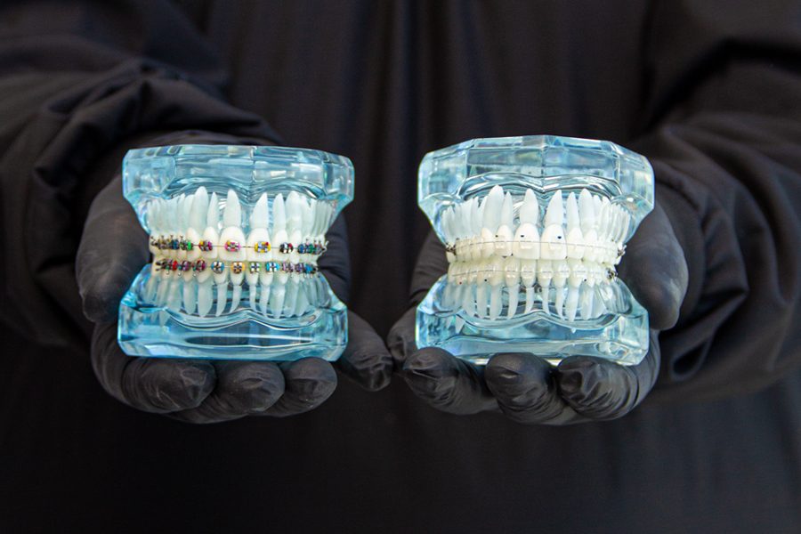 dental implants cancun mexico